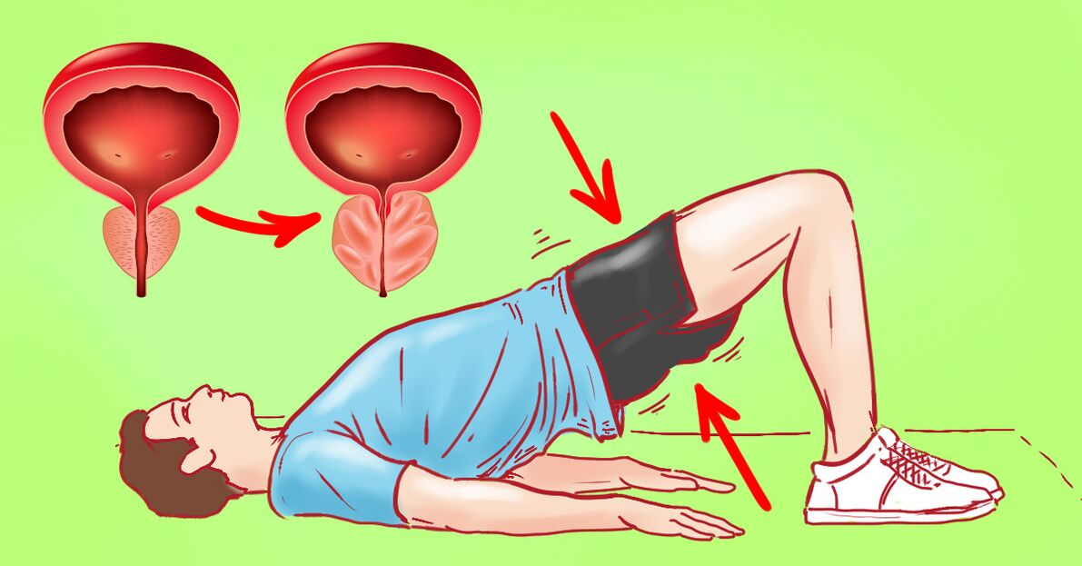 prostatitiserako gimnasia ariketak